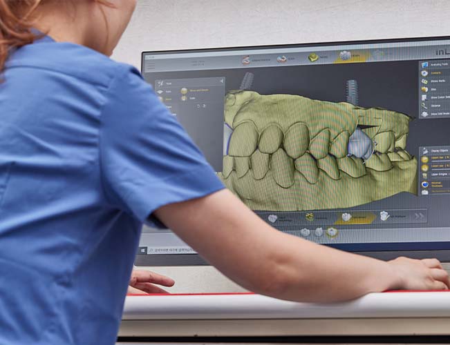 CAD/CAM 정밀가공